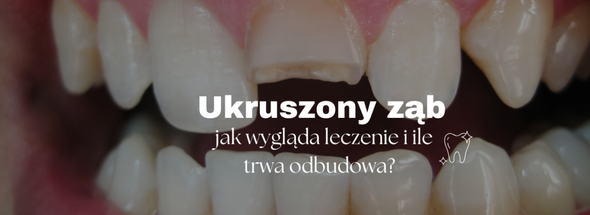 Ukruszony ząb - jak wygląda leczenie i ile trwa odbudowa?