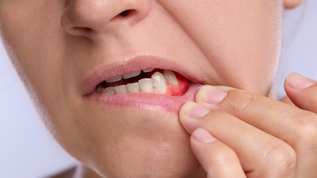 Odpowiednia higiena i regularne kontrole pomagają ograniczyć skutki recesji dziąseł