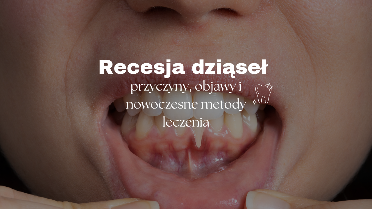 Recesja dziąseł - przyczyny, objawy i nowoczesne metody leczenia