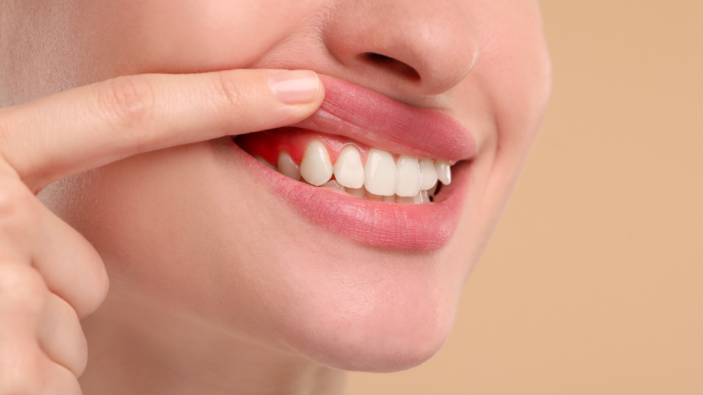 Wczesne rozpoznanie problemu, jakim jest recesja dziąseł, pozwala skutecznie zahamować jej postęp