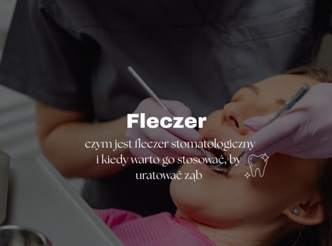 Fleczer - czym jest fleczer stomatologiczny i kiedy warto go stosować, by uratować ząb