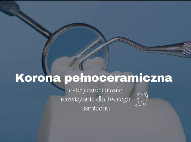 Korona pełnoceramiczna – estetyczne i trwałe rozwiązanie dla Twojego uśmiechu