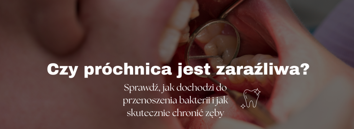 Czy próchnica jest zaraźliwa? Sprawdź, jak dochodzi do przenoszenia bakterii i jak skutecznie chronić zęby