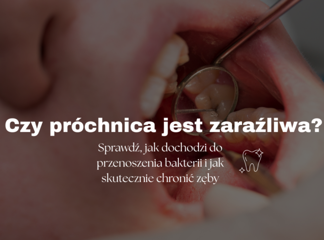 Czy próchnica jest zaraźliwa? Sprawdź, jak dochodzi do przenoszenia bakterii i jak skutecznie chronić zęby
