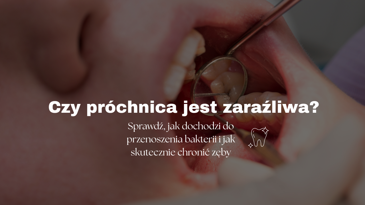 Czy próchnica jest zaraźliwa? Sprawdź, jak dochodzi do przenoszenia bakterii i jak skutecznie chronić zęby