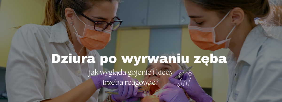 Dziura po wyrwaniu zęba - jak wygląda gojenie i kiedy trzeba reagować?