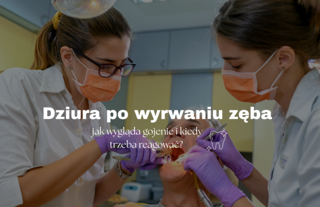 Dziura po wyrwaniu zęba - jak wygląda gojenie i kiedy trzeba reagować?