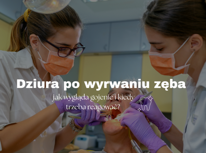 Dziura po wyrwaniu zęba - jak wygląda gojenie i kiedy trzeba reagować?