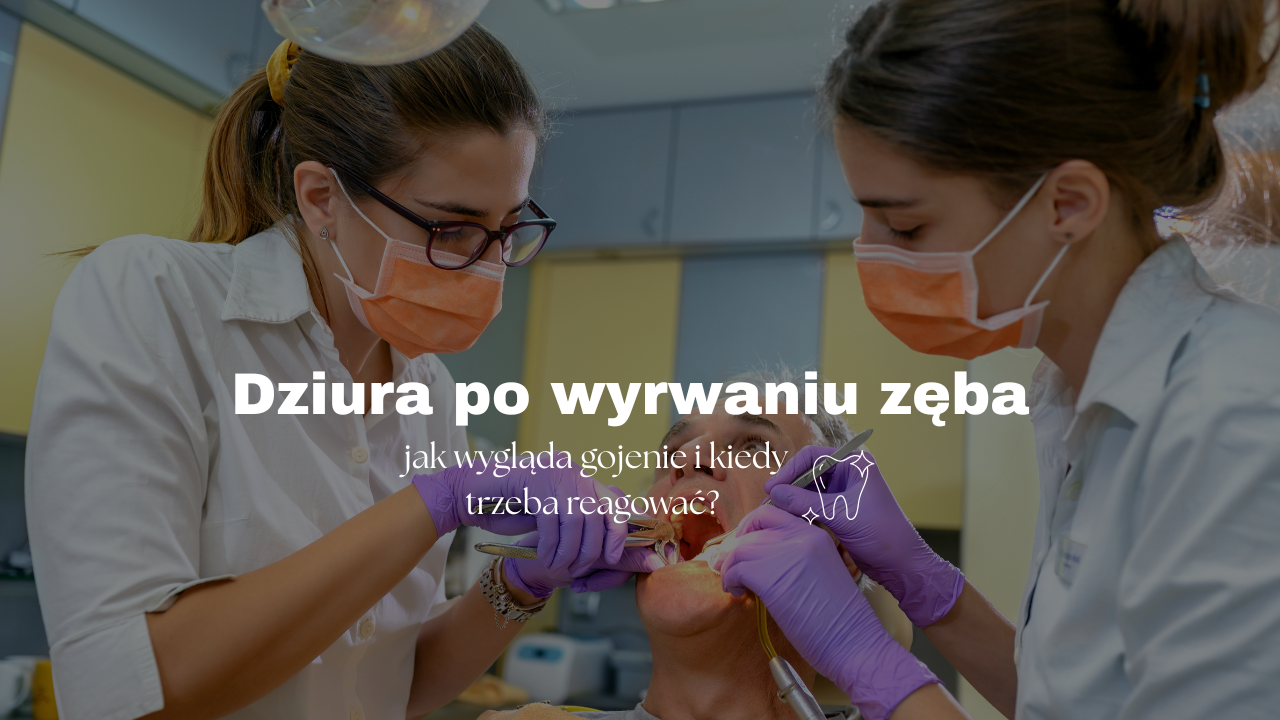Dziura po wyrwaniu zęba - jak wygląda gojenie i kiedy trzeba reagować?