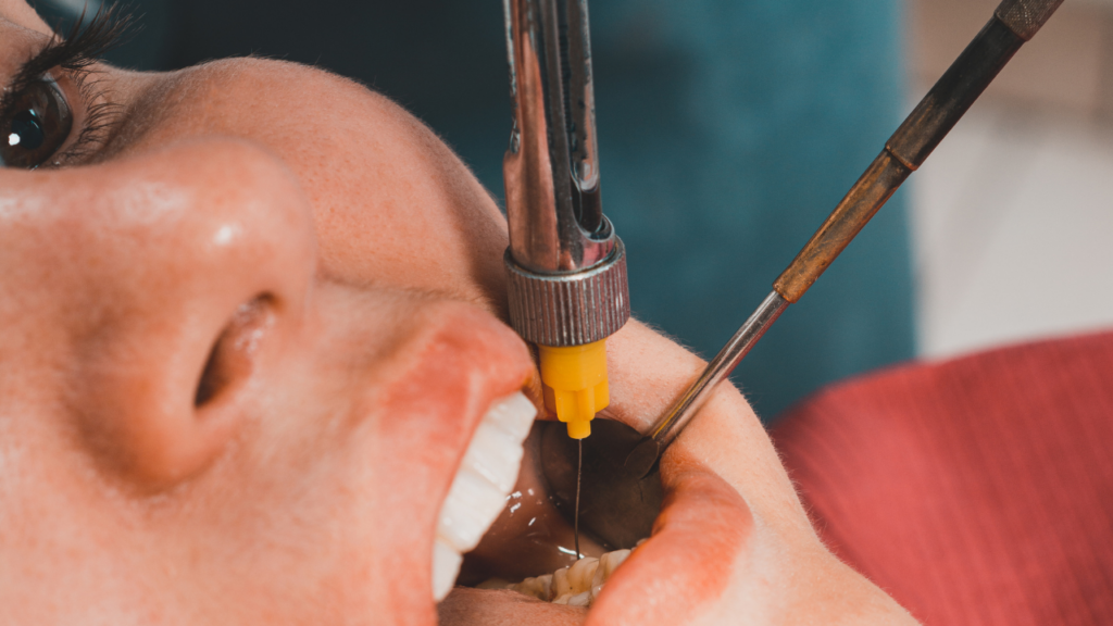 Nowoczesne metody znieczulenia dentystycznego pomagają przeprowadzić zabieg spokojnie i bezpiecznie