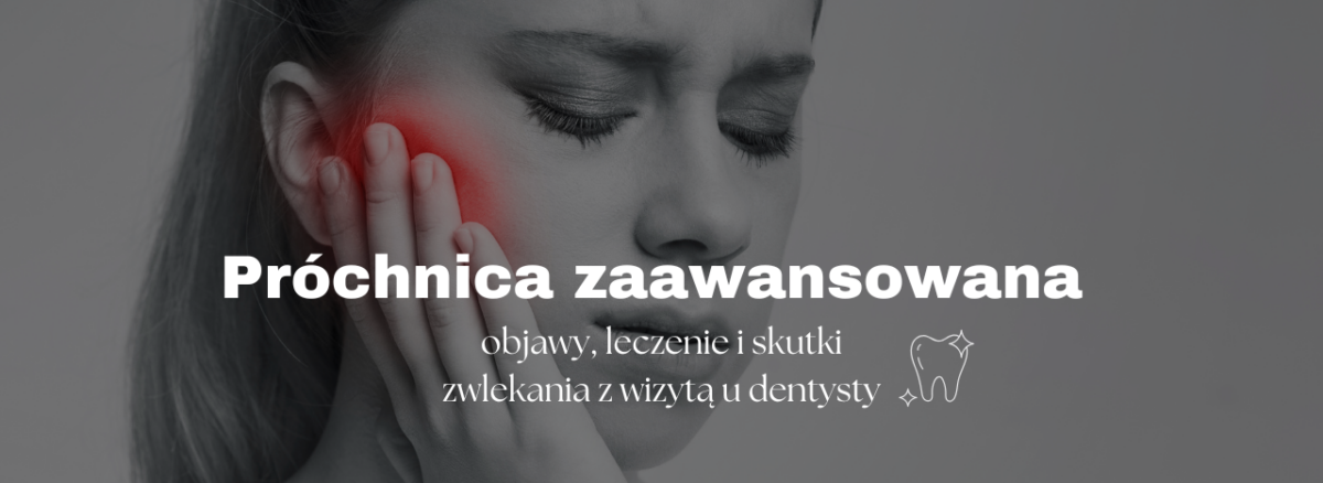 Próchnica zaawansowana - objawy, leczenie i skutki zwlekania z wizytą u dentysty