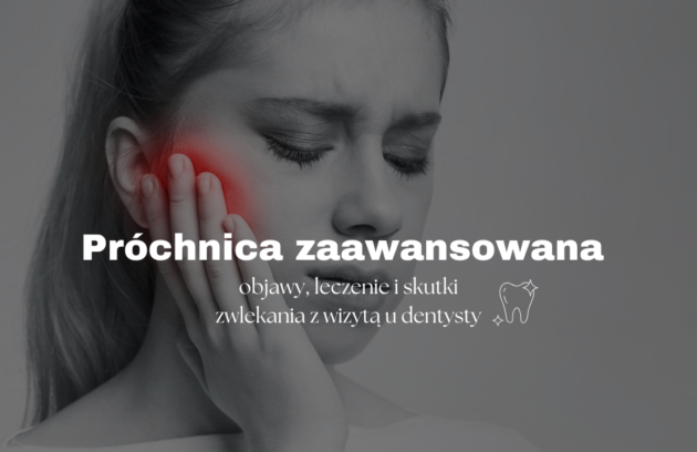 Próchnica zaawansowana - objawy, leczenie i skutki zwlekania z wizytą u dentysty