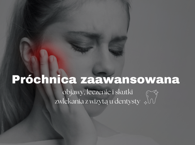 Próchnica zaawansowana - objawy, leczenie i skutki zwlekania z wizytą u dentysty
