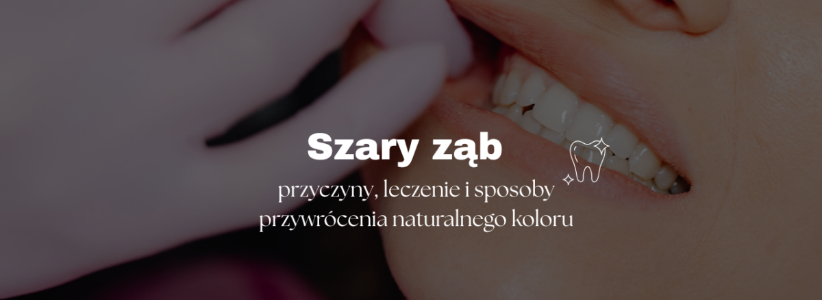 przyczyny, leczenie i sposoby przywrócenia naturalnego koloru