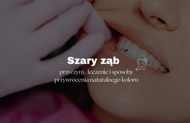 przyczyny, leczenie i sposoby przywrócenia naturalnego koloru