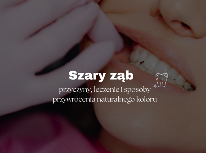 przyczyny, leczenie i sposoby przywrócenia naturalnego koloru