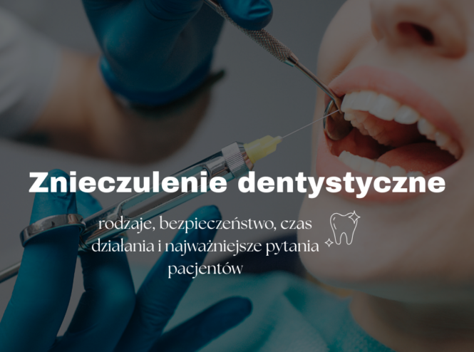 Znieczulenie dentystyczne - rodzaje, bezpieczeństwo, czas działania i najważniejsze pytania pacjentów