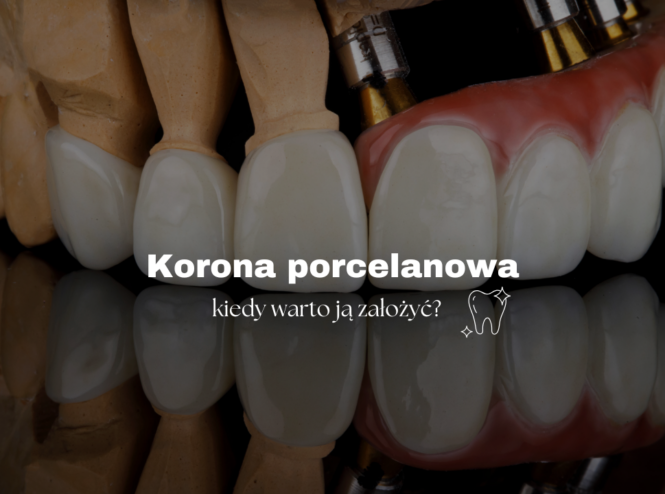 Korona porcelanowa - kiedy warto ją założyć?