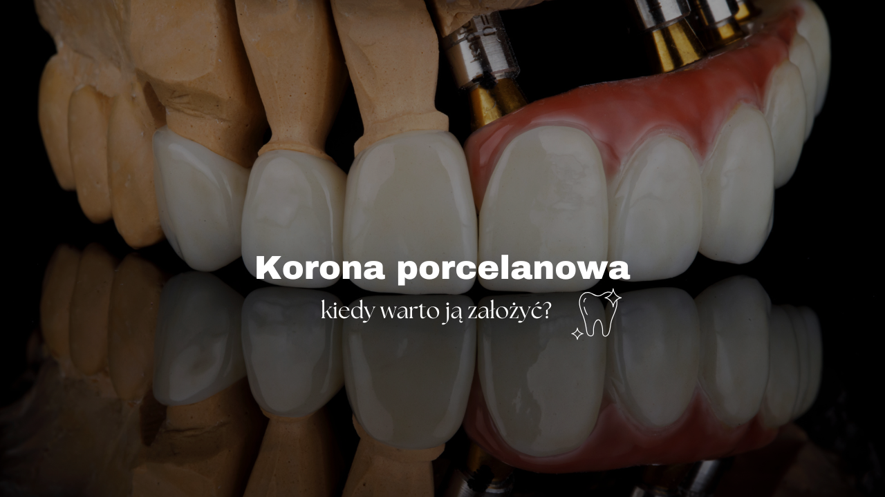 Korona porcelanowa - kiedy warto ją założyć?