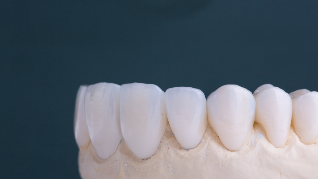 Korona porcelanowa sprawdza się wtedy, gdy zwykłe wypełnienie nie wystarcza do trwałej odbudowy zęba