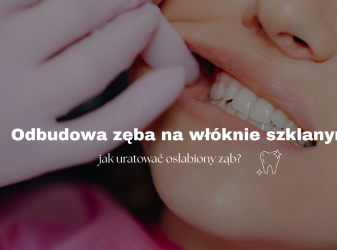 Odbudowa zęba na włóknie szklanym - jak uratować osłabiony ząb?