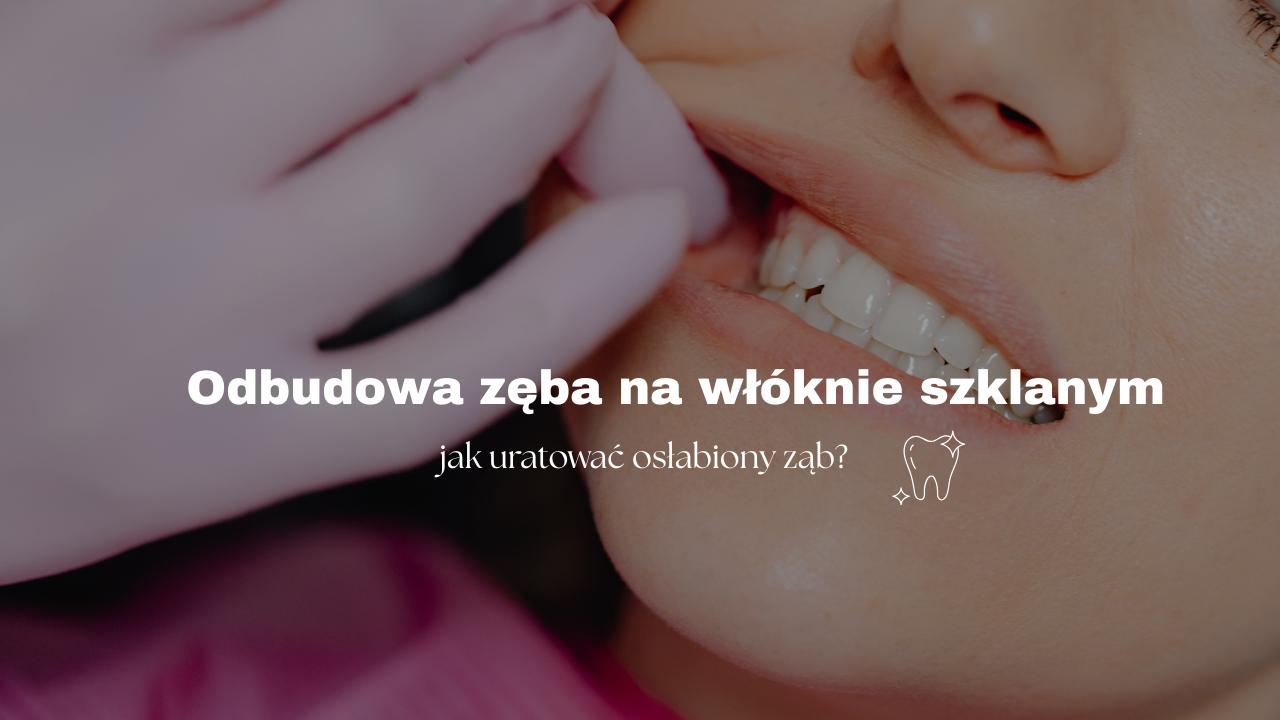 Odbudowa zęba na włóknie szklanym - jak uratować osłabiony ząb?