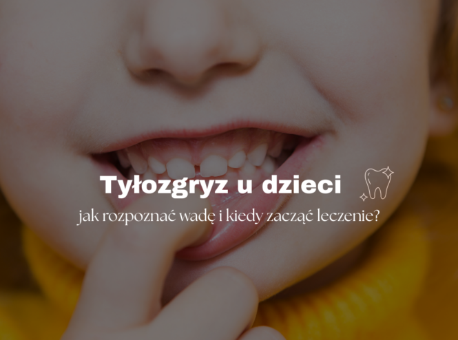 Tyłozgryz u dzieci - jak rozpoznać wadę i kiedy zacząć leczenie?