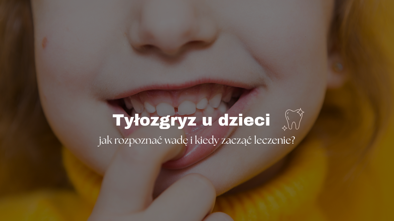 Tyłozgryz u dzieci - jak rozpoznać wadę i kiedy zacząć leczenie?