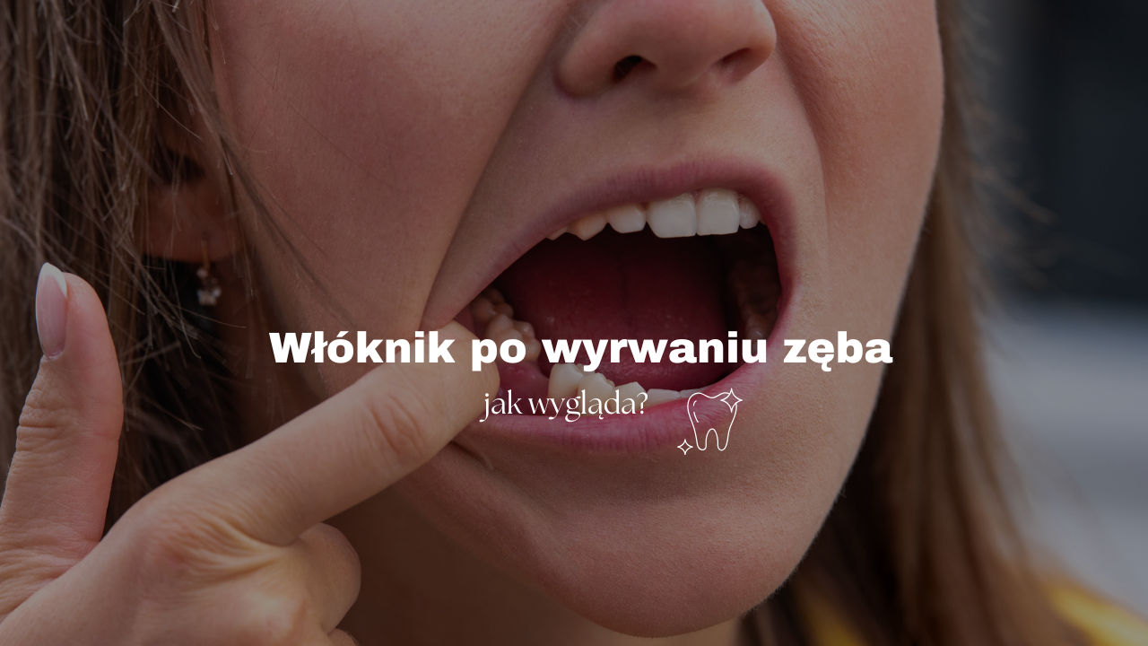 Włóknik po wyrwaniu zęba - jak wygląda?