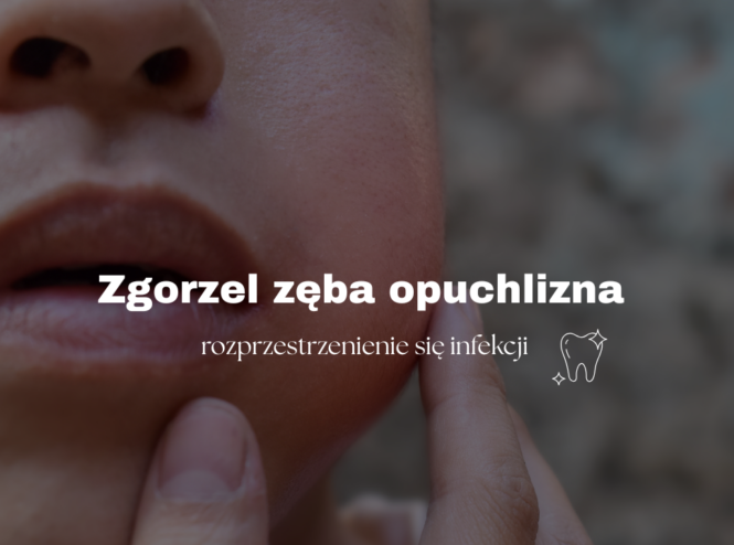 Zgorzel zęba opuchlizna - rozprzestrzenienie się infekcji 