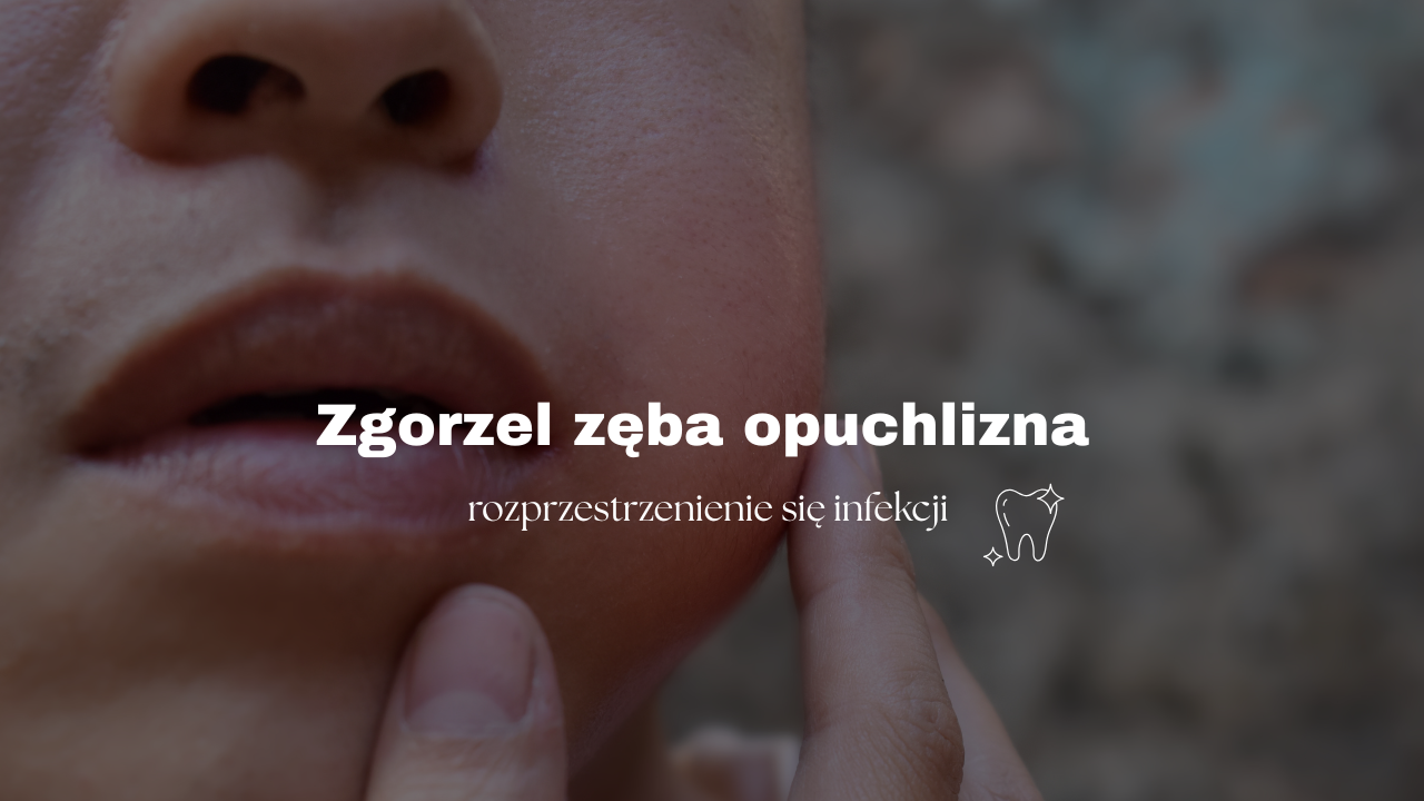 Zgorzel zęba opuchlizna - rozprzestrzenienie się infekcji 