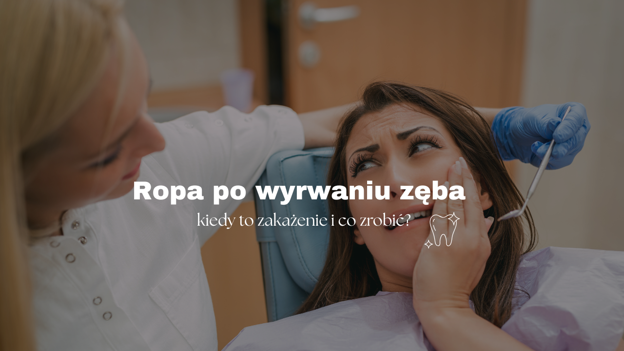 Ropa po wyrwaniu zęba - kiedy to zakażenie i co zrobić?