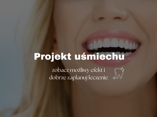 Projekt uśmiechu - zobacz możliwy efekt i dobrze zaplanuj leczenie
