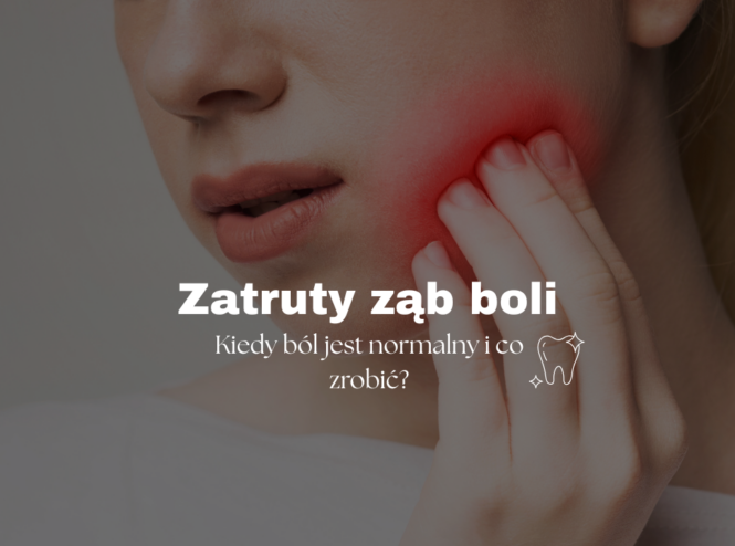 Zatruty ząb boli - sprawdź, kiedy ból jest normalny i co zrobić