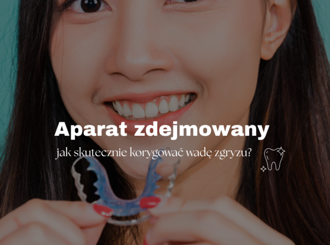 Aparat zdejmowany
