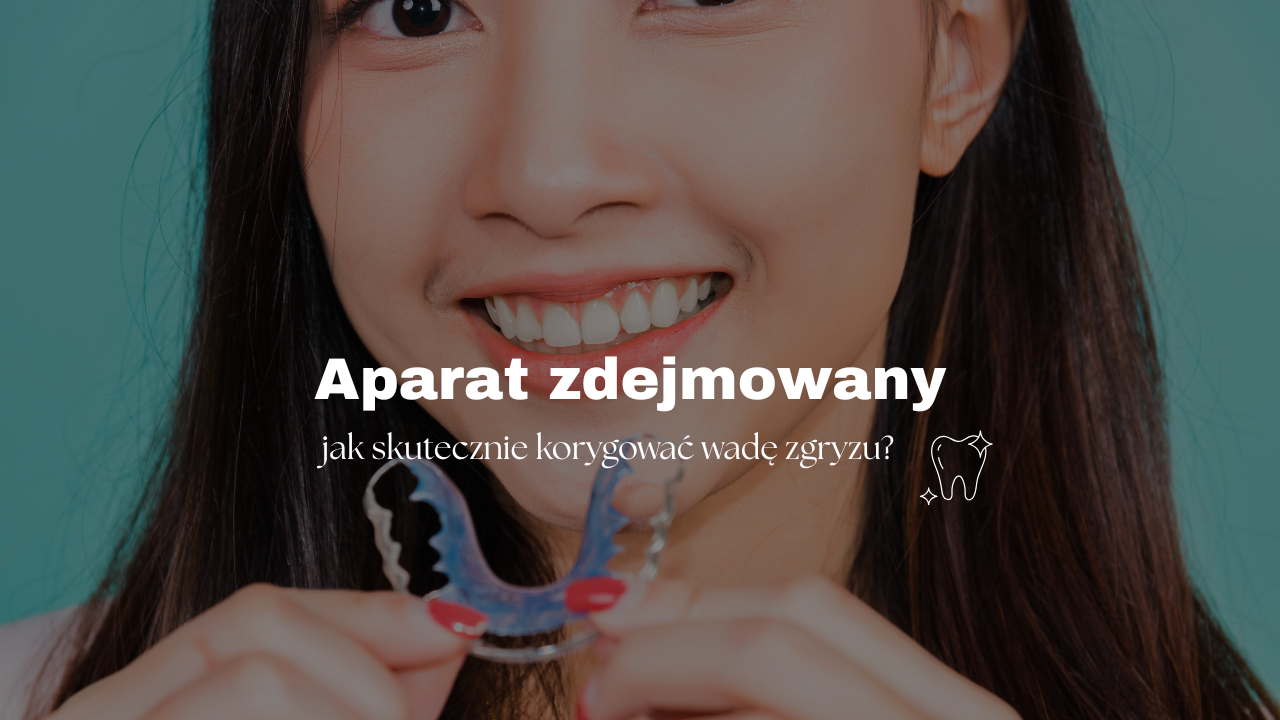 Aparat zdejmowany