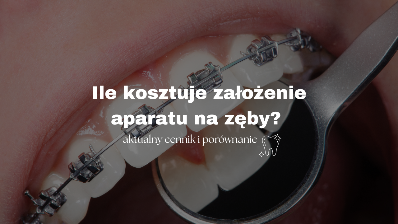 Ile kosztuje założenie aparatu na zęby? - Aktualny cennik i porównanie